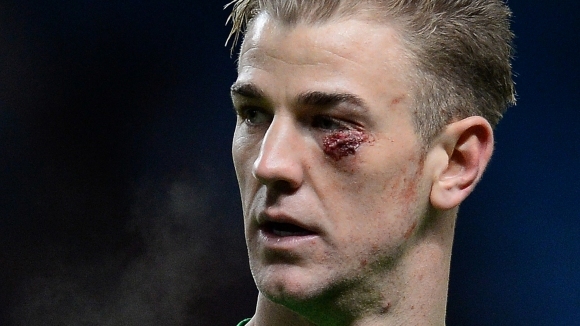 Националът на Англия Джо Харт бе ограбен близо до тренировъчната