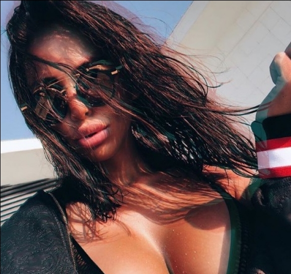 Най предизвикателната българка Николета Лозанова се сдоби с нови устни