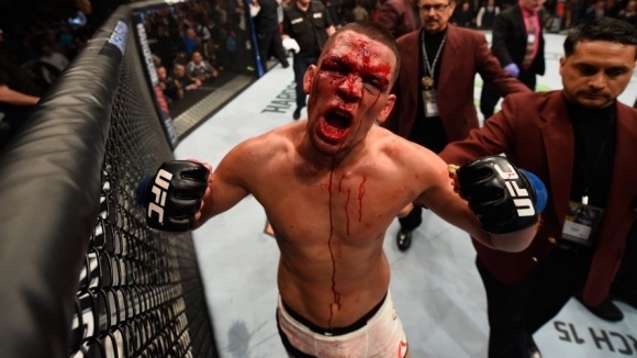 UFC суперзвездата Нейт Диаз отново влезе в полезрението на ММА