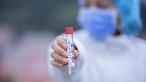 1872 са потвърдените случаи на COVID 19 у нас по данни