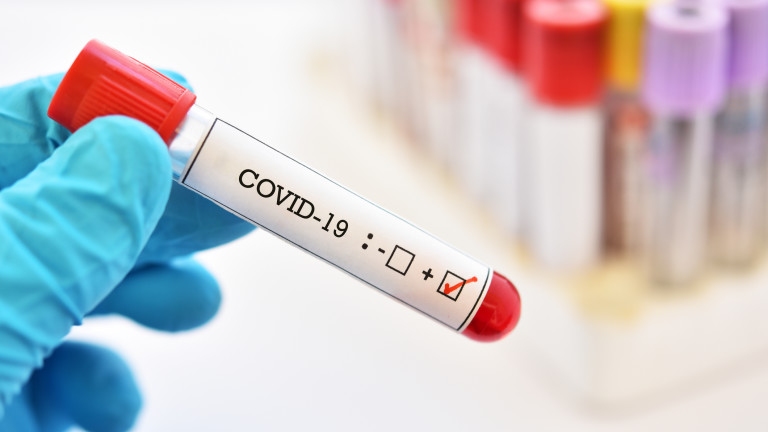 Девет положителни проби за COVID 19 са били установени днес в