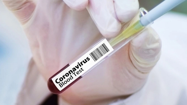 143 нови случая на коронавирус са регистрирани у нас през