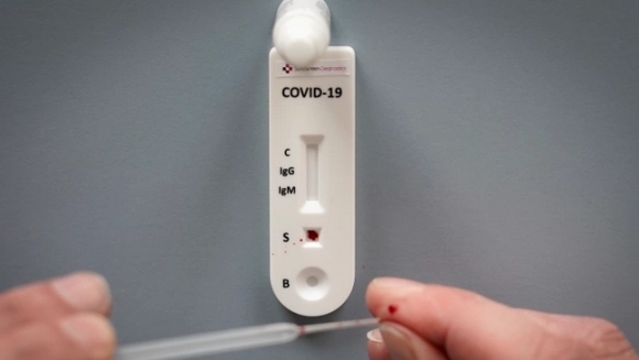 1 589 са новите случаи на коронавирус у нас за