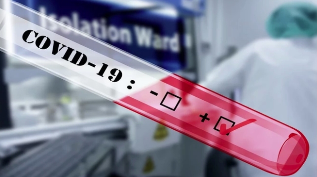 3839 са новодиагностицираните с COVID 19 лица през изминалото денонощие 13