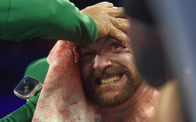 Желанието на Тайсън Фюри да се пробва в смесените бойни