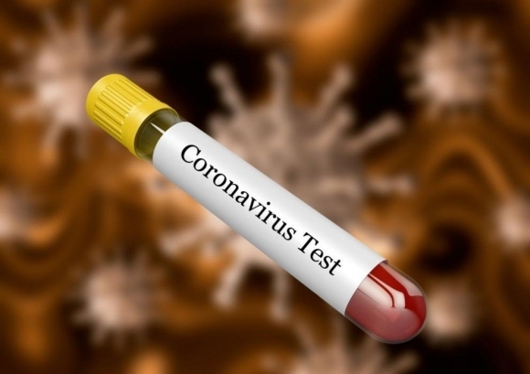 3097 са новите случаи на коронавирусна инфекция през изминалото денонощие